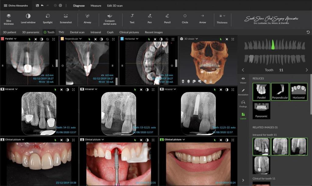 3D Imaging Quincy MA | Cone Beam CT